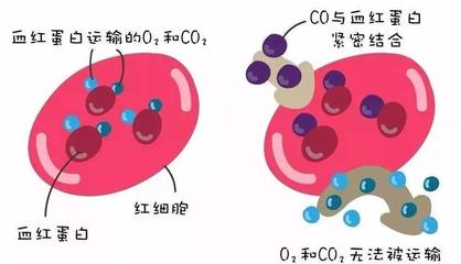 警惕洗澡季隱形殺手 一氧化碳中毒康復后，當心遲發(fā)性腦病